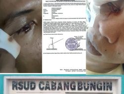 Viral “, Dugaan Mal Praktik RSUD Cabangbungin Korban Mita Keadilan Datang Membawa Mata Pulang Menjadi Buta
