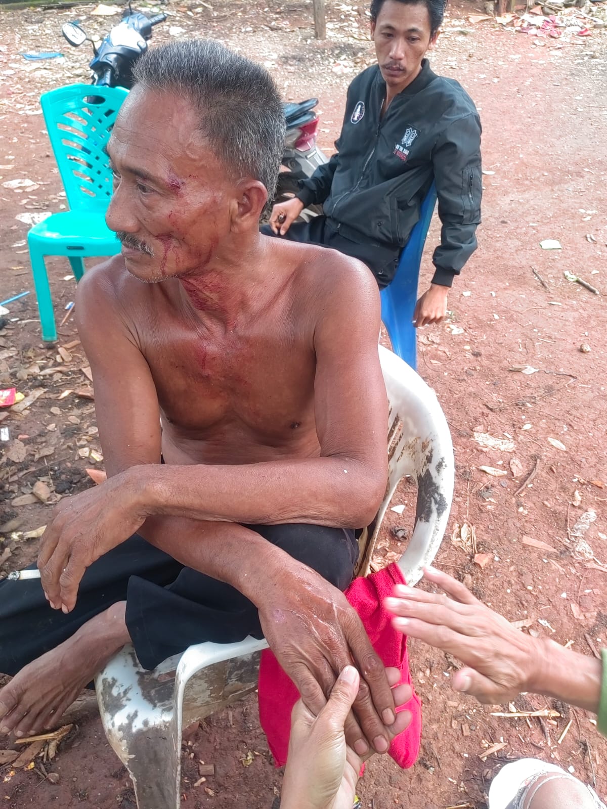 Penganiayaan Mandor Boyong Oleh Oknum TNI Sampai Berdarah-Darah